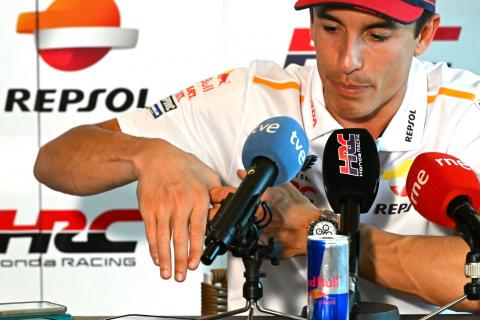 Explained: Marquez’s complex injury, the screws in his hand, the hidden danger Explained: Marquez’s complex injury, the screws in his hand, the hidden danger