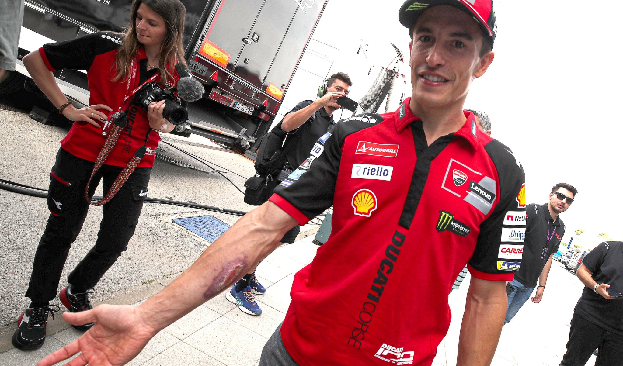 Marc Marquez shows COTA wound ahead of Spanish MotoGP